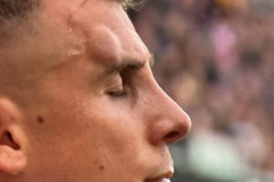 硬漢??迪涅頭上撞出一個清晰可見的大包，仍堅持比賽