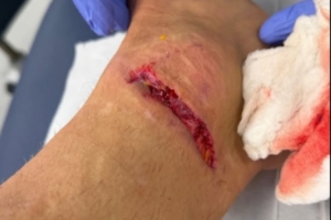 丹索：迪涅在場(chǎng)邊我向他道了歉，確實(shí)碰到了他，但我明顯先清了球