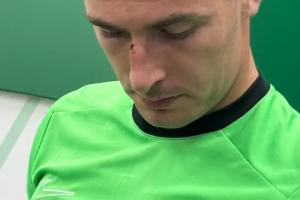 VAR介入不犯規(guī)！佩尼亞和維尼修斯相撞+遭絕平，賽后鼻梁留下傷痕