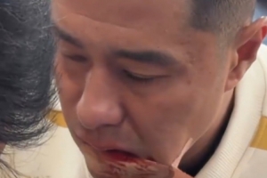 硬漢！國安足協(xié)杯奪冠后，侯森在場邊默默處理嘴部傷口